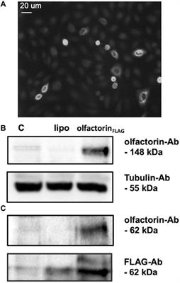 Anosmin-1-Like Effect of UMODL1/Olfactorin on the Chemomigration of Mouse GnRH Neurons and Zebrafish Olfactory Axons Development